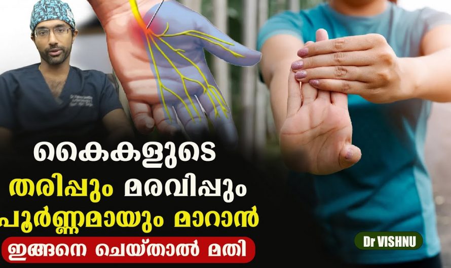 കൈകളിൽ ഉണ്ടാകുന്ന തരിപ്പും മരവിപ്പും മാറ്റാൻ ഇതാ ഡോക്ടർ പറയുന്ന എളുപ്പവഴി. | Carpel Tunel Syndrom