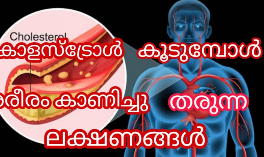 ശരീരത്തിൽ കൊളസ്ട്രോൾ കൂടുതലാണെങ്കിൽ ഇതായിരിക്കും അതിന്റെ ലക്ഷണങ്ങൾ. | High Cholesterol Symptoms Health