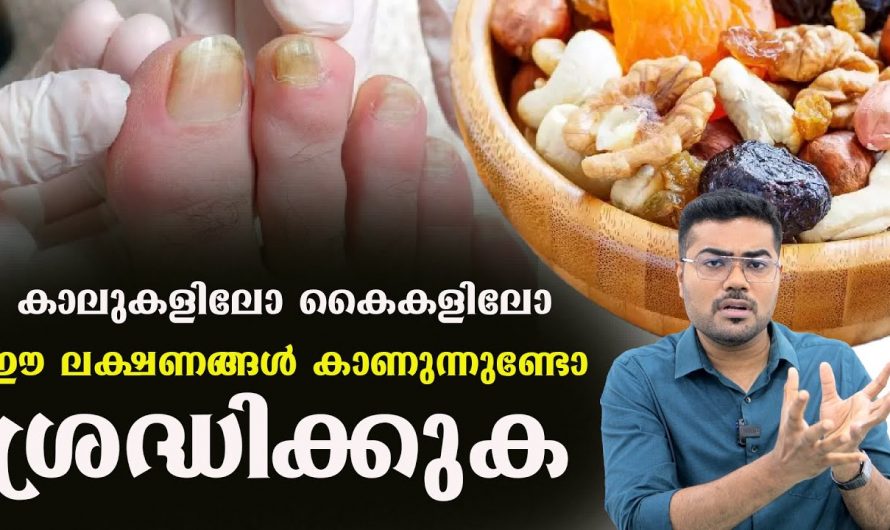 കൈകളിലും കല്ലുകളിലും ഈ ലക്ഷണങ്ങൾ കാണുന്നുണ്ടെങ്കിൽ അതിനെ നിസ്സാരമായി കാണരുത്. അതിന്റെ കാരണം ഇതാണ്. | Reduce Fungal infections