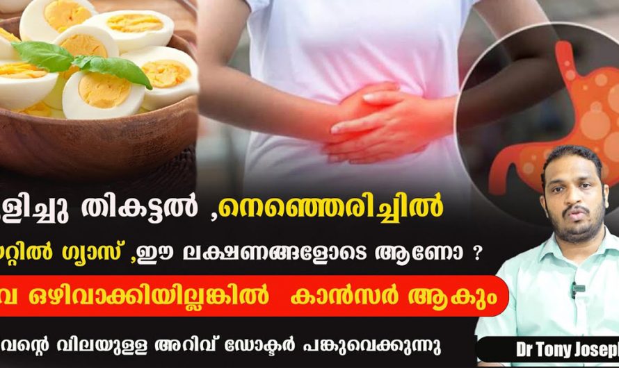 വയറ്റിലെ ക്യാൻസർ ബാധ്യത കുറയ്ക്കാൻ ചെയ്യേണ്ട പ്രധാനപ്പെട്ട കാര്യങ്ങൾ ഇതാ കണ്ടു നോക്കൂ. | Reduce Stomach Cancer