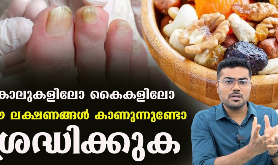 ഇതുപോലെയുള്ള ലക്ഷണങ്ങൾ കണ്ടാൽ ഉടനെ ചികിത്സിക്കു. ഇല്ലെങ്കിൽ ഗുരുതരമായിരിക്കും. | Skin Fungus Remove