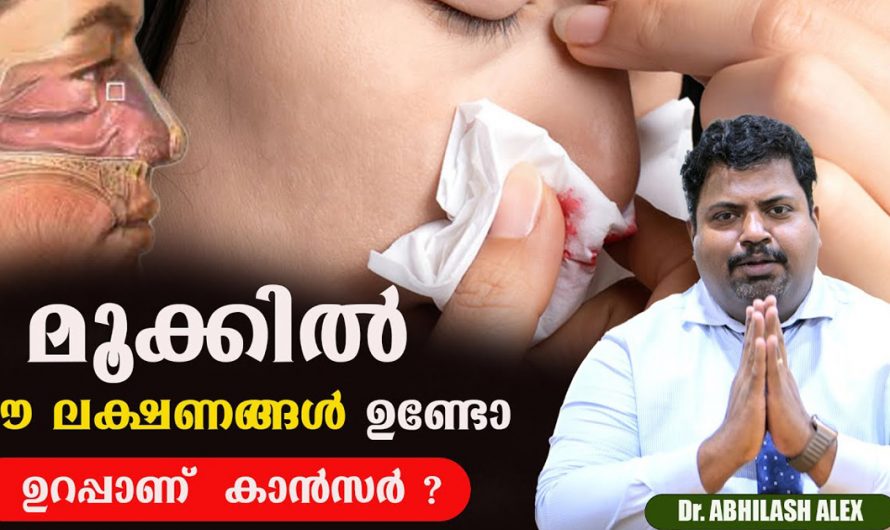 മൂക്കിൽ കാണുന്ന ഇത്തരം ലക്ഷണങ്ങളെ ഗൗരവമായി തന്നെ കാണണം. ഇതുപോലെയുള്ള ലക്ഷണങ്ങൾ അനുഭവപ്പെട്ടിട്ടുണ്ടോ? | Nose Care Tip