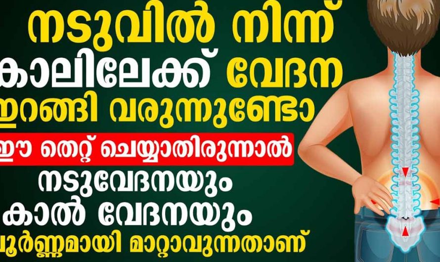 നടുവേദന കൊണ്ടുള്ള ഇത്തരം ബുദ്ധിമുട്ടുകളെ ഇല്ലാതാക്കാൻ ഇതാ എളുപ്പ മാർഗ്ഗം. ഈ തെറ്റ് ചെയ്യാതിരുന്നാൽ മതി. | Back Pain Relief