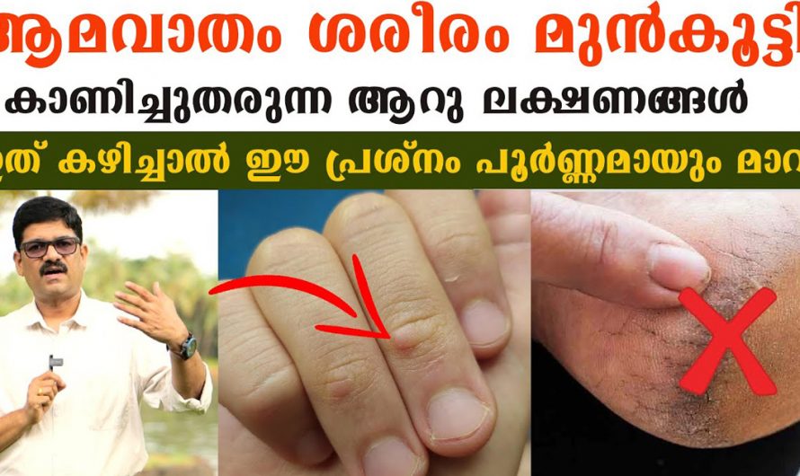 ആമവാതത്തിന് പൂർണ്ണപരിഹാരം ഇത് കഴിച്ചാൽ മതി. Health Care Tips Malayalam