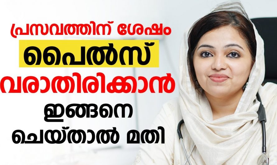 ഗർഭകാലത്തുണ്ടാകുന്ന പൈൽസ് പൂർണ്ണമായും നീക്കാം. ഇതുപോലെ ചെയ്താൽ മതി. | Prevent Piles During Pregnancy