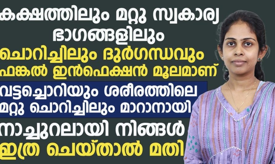 വട്ടച്ചെറിയും ശരീരത്തിലെ മറ്റു ചൊറിച്ചിലും മാറാനായി നാച്ചുറൽ ആയിട്ട് ഇങ്ങനെ ചെയ്താൽ മതി. | Remove Ring Worm