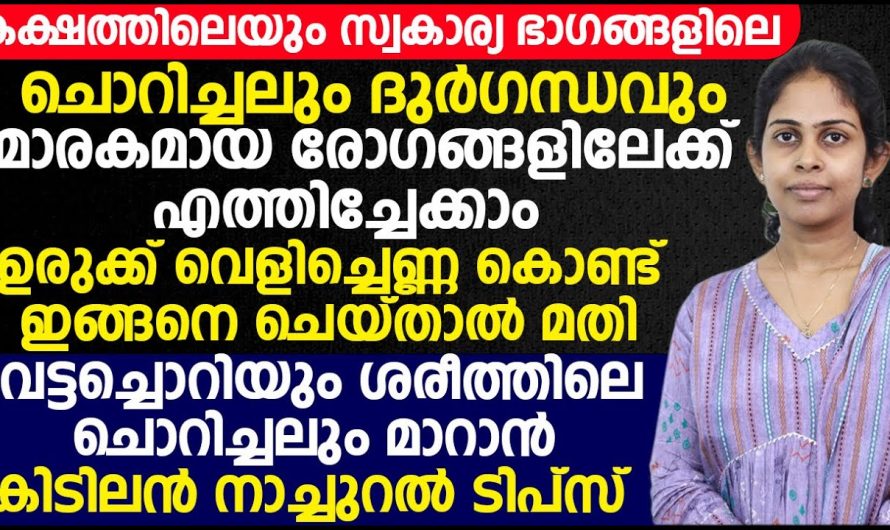 ഫംഗസ് അണുബാധയ്ക്ക് അത്യുഗ്രൻ വീട്ടുവൈദ്യങ്ങൾ…