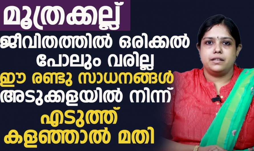 ‘കിഡ്നി സ്റ്റോൺ ‘  ഇനി ആശങ്ക വേണ്ട ഇതാ പരിഹാരമാർഗങ്ങൾ…