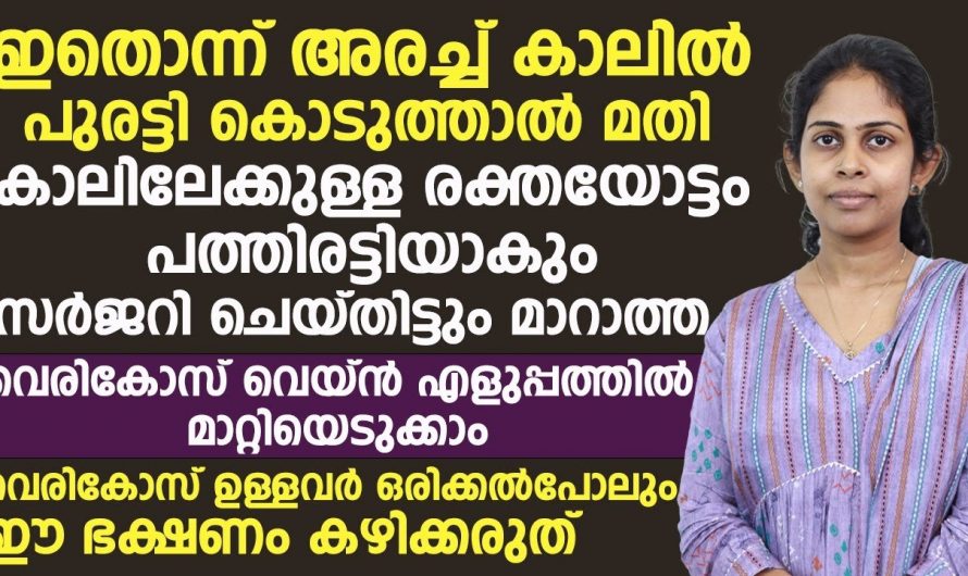 നിങ്ങളുടെ ഞരമ്പുകൾ ഇതുപോലെ കാണുന്നുണ്ടോ എന്നാൽ സൂക്ഷിക്കുക..