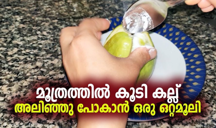 കിഡ്നി സ്റ്റോൺ ഇല്ലാതാക്കാൻ ഒരു കിടിലൻ ഒറ്റമൂലി… ഇനി വേറൊന്നും അന്വേഷിച്ചു പോവേണ്ട.