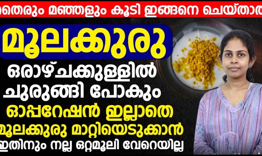 തൈരും മഞ്ഞളും ഉപയോഗിച്ച് മൂലക്കുരു ഇനി ഓപ്പറേഷൻ ചെയ്യാതെ മാറ്റിയെടുക്കാം. ഇതിലും നല്ലൊരു ഒറ്റമൂലി വേറെയില്ല. | Piles Removing Health Tips