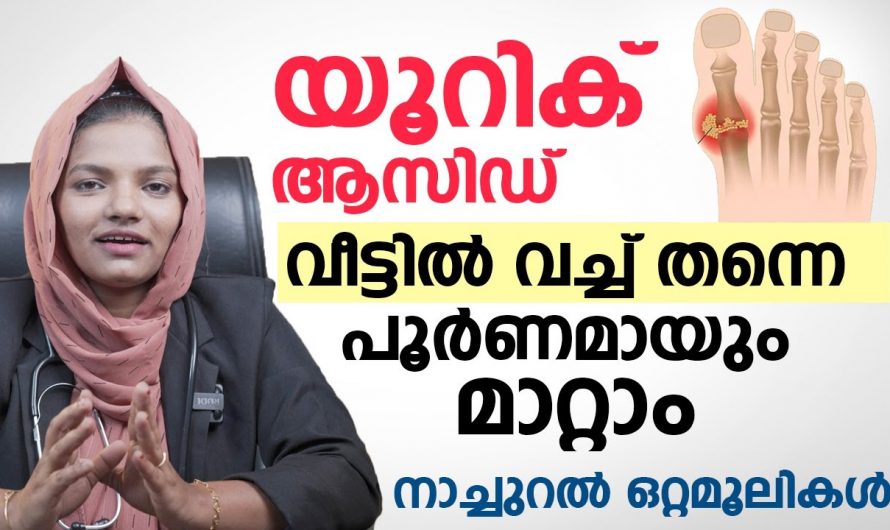 യൂറിക്കാസിഡ് കുറയ്ക്കാനുള്ള ട്രീറ്റ്മെന്റ് ഇനി വീട്ടിലുണ്ട്. ഇതുപോലെ പൂർണമായി മാറ്റാം. | Treatment to reduce uric acid