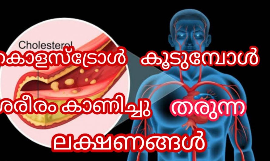 ശരീരത്തിൽ കൊളസ്ട്രോൾ കൂടുമ്പോൾ കാണുന്ന പ്രധാനപ്പെട്ട ലക്ഷണങ്ങൾ  | Important Symptoms of High Cholesterol