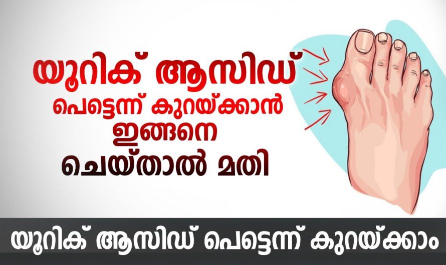 യൂറിക് ആസിഡ് ഉയരാനുള്ള കാരണങ്ങൾ ഇവയൊക്കെയാണ്.. ഇത് പൂർണ്ണമായും ഒഴിവാക്കണം..