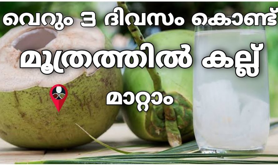 മൂത്രത്തിൽ കല്ല് മാറാൻ ഇതിലും നല്ല മരുന്ന് വേറെയില്ല..