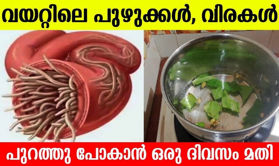 വിരശല്യം കൊണ്ട് ഇനി ബുദ്ധിമുട്ടേണ്ടി വരില്ല ഈ പൊടിക്കൈകൾ ചെയ്തു നോക്കൂ….