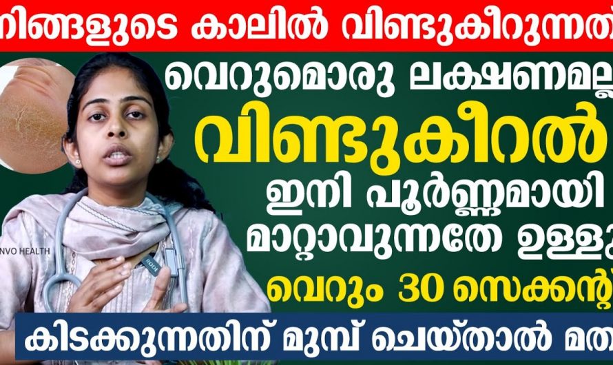 പാദങ്ങളിലെ വിണ്ടുകീറൽ മാറണമെങ്കിൽ നിങ്ങൾ ചെയ്യേണ്ടത് ഇത്രമാത്രം..