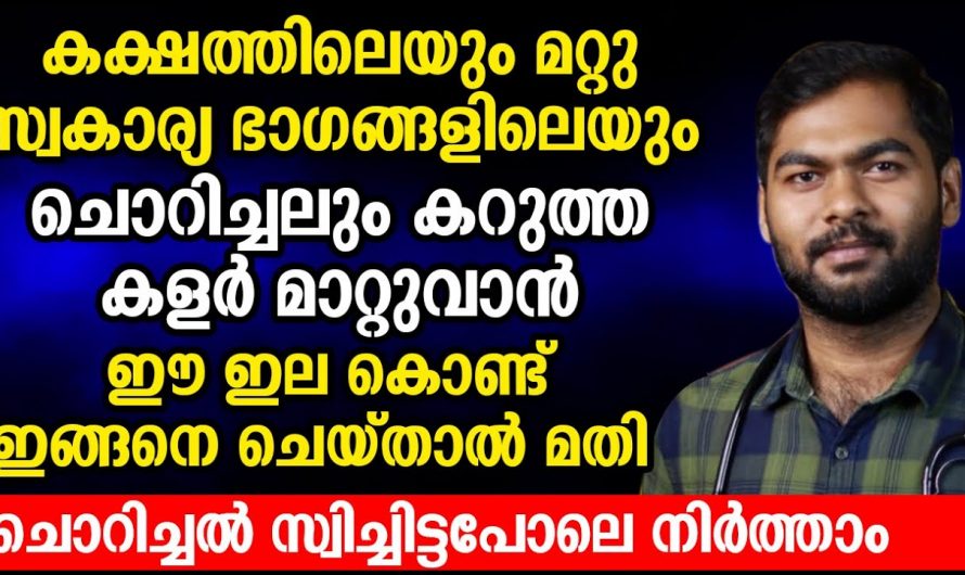 സോറിയോസിസ് ഒരു നിസ്സാര ചർമ്മരോഗം അല്ല.., ചികിത്സിച്ചില്ലെങ്കിൽ ഗുരുതരമാവും…