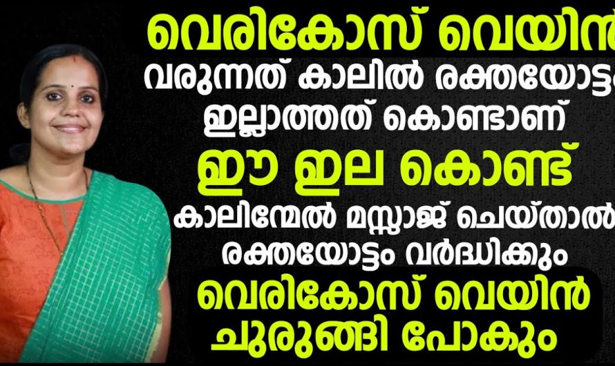 ഈ തെറ്റ് ഒരിക്കലും ചെയ്യരുത്, ഇതാണ് വെരിക്കോസ് വെയിൻ വരുന്നതിന് കാരണമാകുന്നത്…