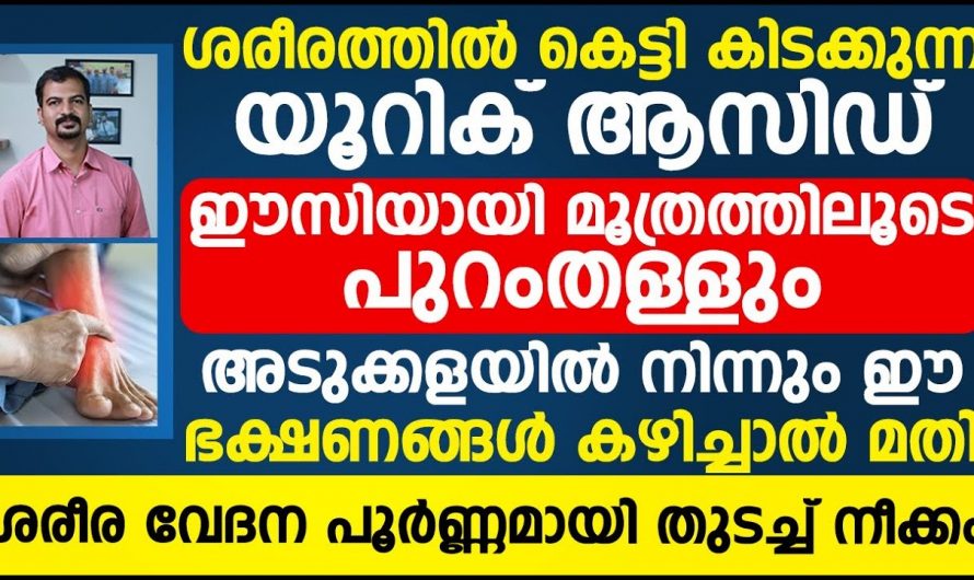 ഈ രോഗലക്ഷണങ്ങൾ യൂറിക്കാസിഡ് കൂടുന്നതിന്റെതാണ്…