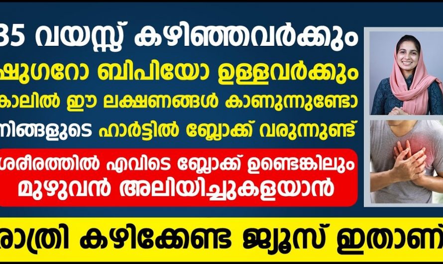 ഹാർട്ട് ബ്ലോക്ക് വരാതിരിക്കാൻ ഈ കാര്യങ്ങൾ ശ്രദ്ധിച്ചാൽ മതി, ഡോക്ടറുടെ അഭിപ്രായം കേൾക്കൂ…