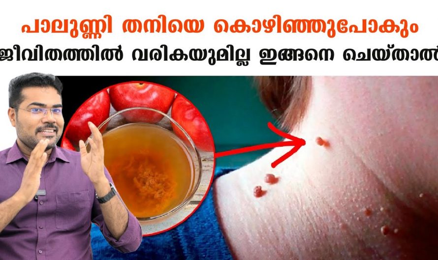 പാലുണ്ണി വരുന്നതിന് പിന്നിലെ രഹസ്യം, ഇത് നിസ്സാരമല്ല ഉടൻ തന്നെ കാരണം കണ്ടെത്തുക…