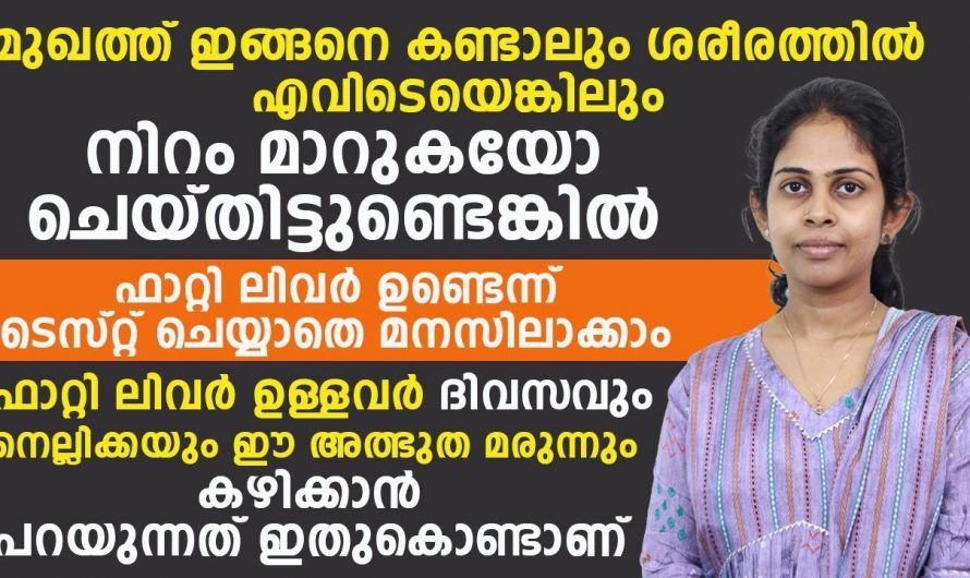 ഫാറ്റി ലിവർ ഉണ്ടെന്നറിഞ്ഞാൽ ഉടൻതന്നെ ഇത് ചെയ്യൂ, എളുപ്പത്തിൽ മാറിക്കിട്ടും…