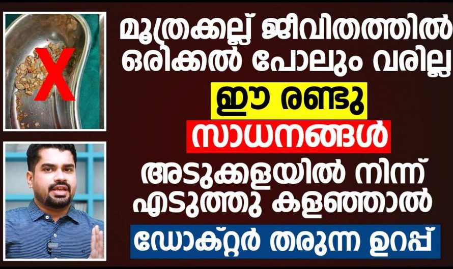 കിഡ്നി സ്റ്റോൺ വരാതിരിക്കാൻ ഇതൊന്ന് ട്രൈ ചെയ്തു നോക്കൂ, വേഗത്തിൽ മാറിക്കിട്ടും….