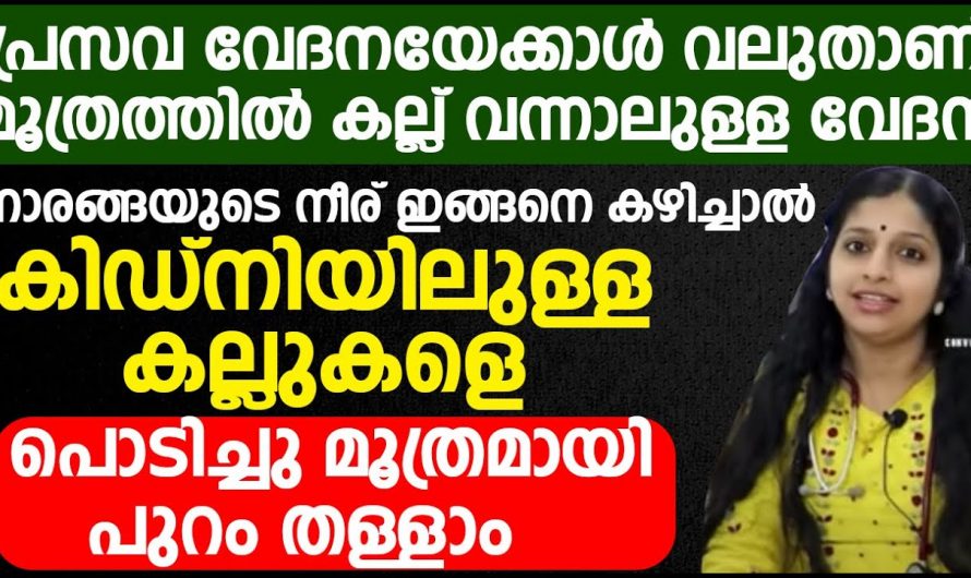 ഈ ലക്ഷണങ്ങൾ ഉള്ളവർ സൂക്ഷിക്കുക, കിഡ്നി സ്റ്റോണിന്‍റെ തുടക്കമാവാം…