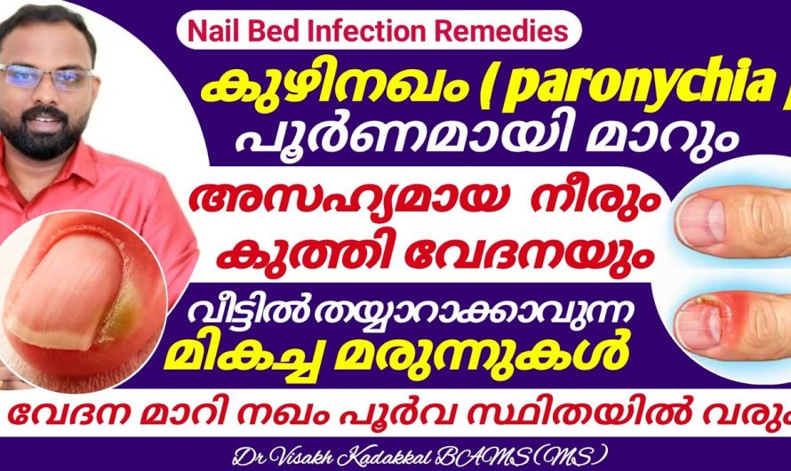 കുഴിനഖം വരുന്നതിനുള്ള കാരണങ്ങൾ ഇതാണ്, ഒരിക്കലും ഈ തെറ്റ് ചെയ്യരുത്…