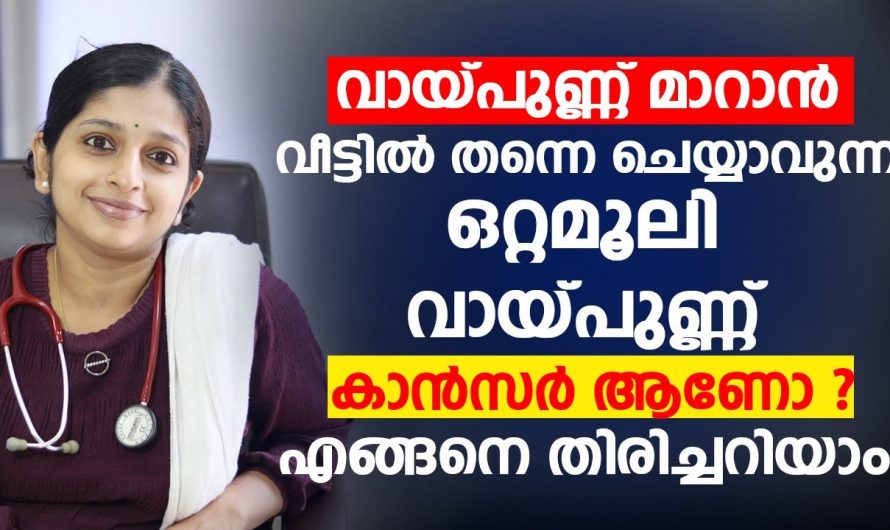 ഇടയ്ക്കിടെ വായ്പ്പുണ്ണ് വരുന്നുണ്ടെങ്കിൽ സൂക്ഷിക്കുക, ഒരു മാരക രോഗത്തിൻറെ സൂചനയാകാം…