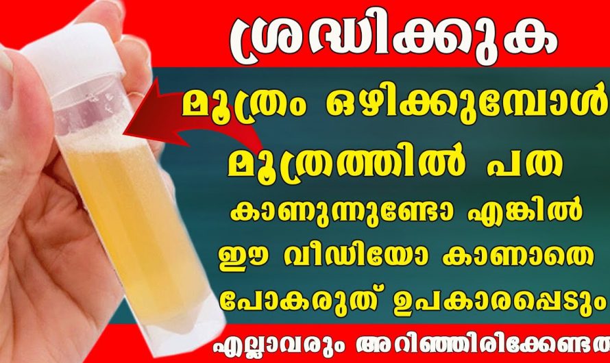 മൂത്രത്തിൽ കാണപ്പെടുന്ന ഈ മാറ്റങ്ങളെ നിസ്സാരമായി കാണരുത്, വൃക്ക തകരാറിന്റെ സൂചനയാവാം..