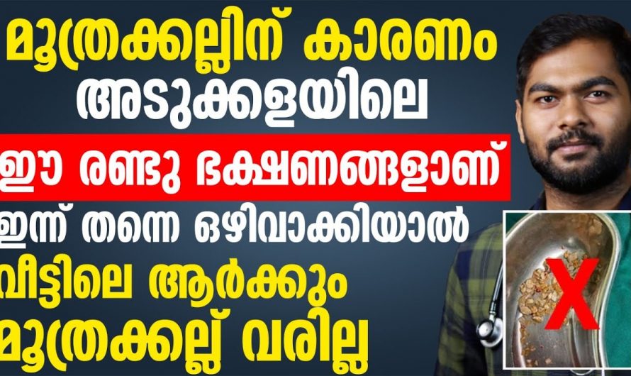 ശരീരത്തിലെ ഈ സൂചനകൾ അവഗണിക്കരുത്, കിഡ്നി സ്റ്റോണിന്റെ തുടക്കമാണ്…