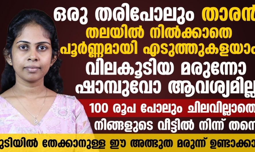 താരൻ വരുന്നതിന്റെ കാരണം ഇതാണ്, പൂർണ്ണമായും മാറ്റാൻ ഇതൊന്നു പരീക്ഷിച്ചു നോക്കൂ…