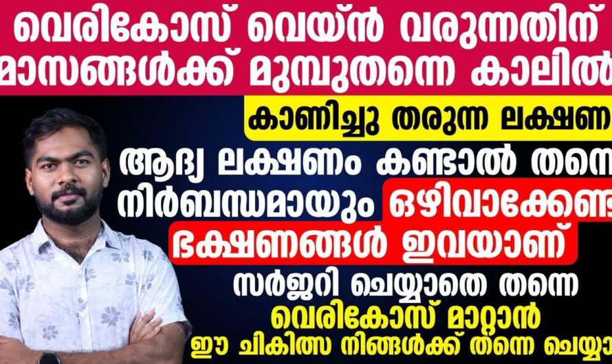 കാലുകളിലെ ഞരമ്പുകളിൽ ഈ മാറ്റങ്ങൾ കാണുന്നവർ സൂക്ഷിക്കുക, ഈ രോഗം നിസാരമല്ല…