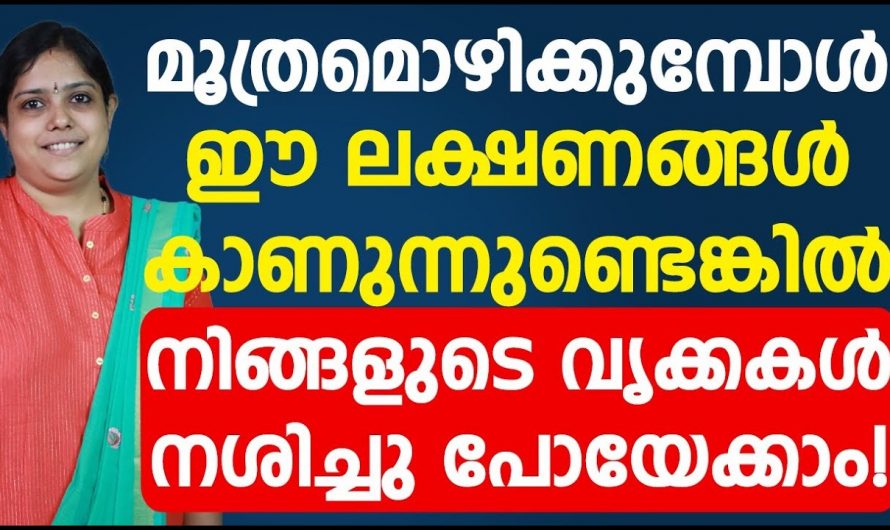 ഈ ലക്ഷണങ്ങൾ ഉണ്ടെങ്കിൽ സൂക്ഷിക്കുക, വൃക്ക തകരാറിൽ ആകാൻ പോകുന്നു…